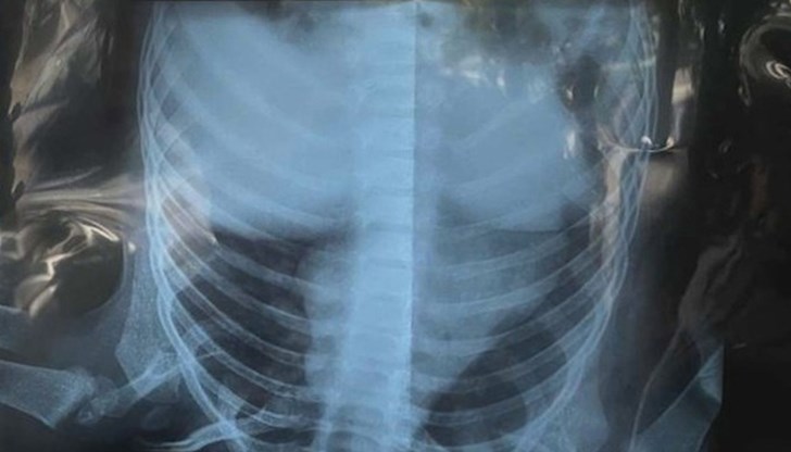 Родителите се съмняват в опит за източване на здравната каса Родителите се съмняват в опит за източване на здравната каса