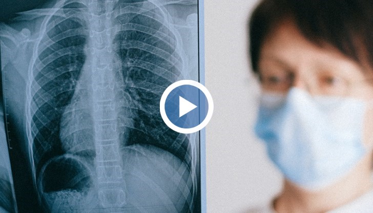 Когато вирусът стигне до белия дроб, тогава може да се развие бурна възпалителна реакция - това е реакция на имунната система, разясни пулмологът д-р Ангелова