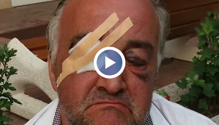 Две седмици след зверския побой над Димитър и след като в социални мрежи и медии се вдигна шум, от полицията се активизираха