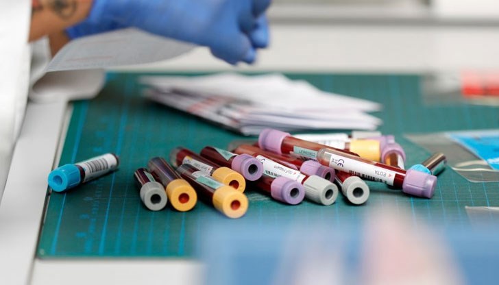 МЗ с нови указания как да се тестваме за антитела