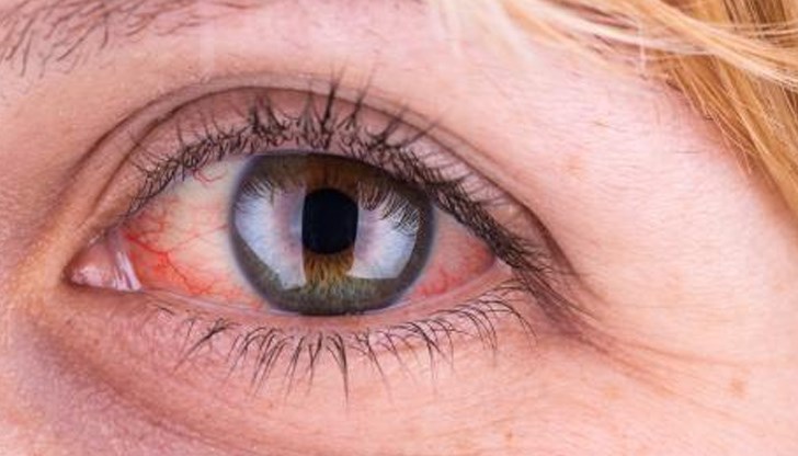 Не използвайте капки за облекчаване на зачервяване, антиалергични или вазоконстрикторни лекарства. Те няма да помогнат, но могат да причинят странични ефекти