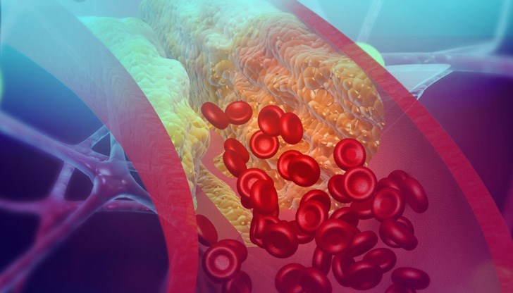 В никакъв случай не бива да си "предписваме" сами антикоагуланти В никакъв случай не бива да си "предписваме" сами антикоагуланти