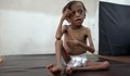 Децата, които не плачат, защото нямат сили - ужасът в Йемен