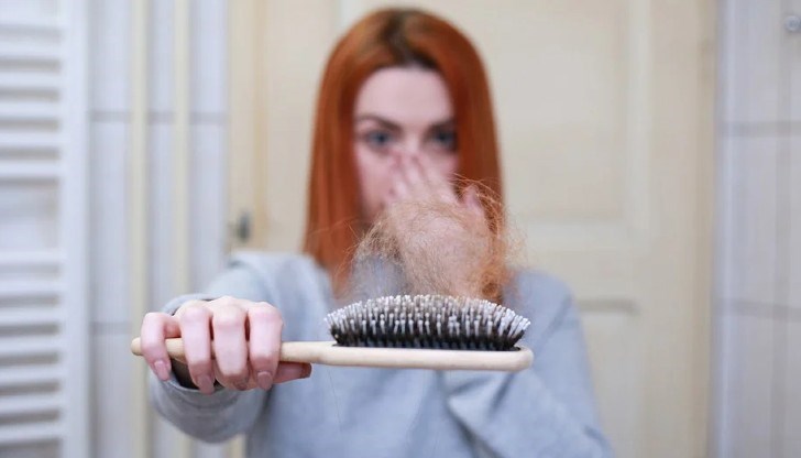 Ако губите повече от 125 косъма на ден, можем да говорим за сериозен косопад