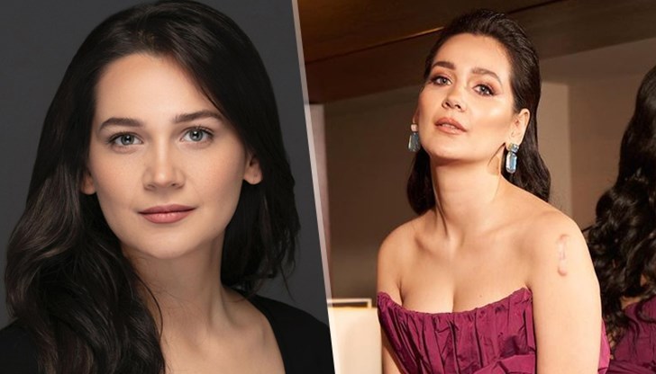 Родената в Русе актриса​ разкри келоид на рамото в стилна фотосесия