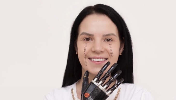 Историята на Маргарита Грачова с бионичната си протеза. На една й буза пише "не ме е срам", а на другата - "тормоз" Историята на Маргарита Грачова с бионичната си протеза. На една й буза пише "не ме е срам", а на другата - "тормоз"