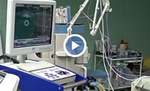 УМБАЛ "Канев" е сред малкото болници в страната, използващи апарат за вътресъдов ултразвук