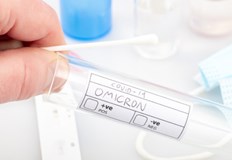 227 случая на вирусния вариант Омикрон на SARS CoV 2 са установени