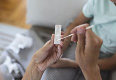 По думите му най засегната е възрастта около 10 годиниСамо за