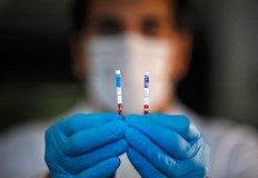 9 871 са новодиагностицираните с коронавирусна инфекция лица у нас