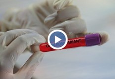 Увеличава се процентът на положителни проби за COVID 19 в област Русе През