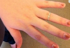 На всеки се е случвало изведнъж да усети натиск в