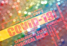 9871 са новите положителни случаи за вируса на COVID у