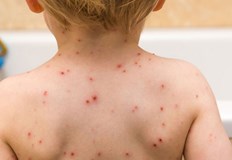 Под средната за страната е заболеваемостта от сезонен грип това