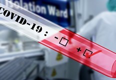 Още 4737 са новозаразените с коронавирус за последното денонощие Те са