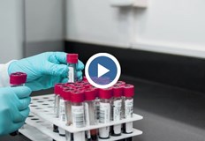 Грипът може да бъде сериозно заболяване Не са необичайни случаите на