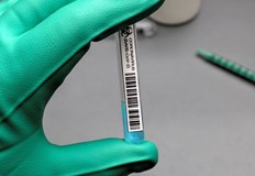 2605 са новодиагностицираните с COVID 19 у нас за изминалите 24