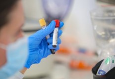 8 116 са новодиагностицираните с COVID 19 лица у нас през