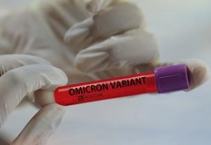 Нови 249 случая на вирусния вариант Омикрон на SARS CoV 2 са