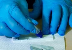 128 нови случая на коронавирус в Русенско са отчетени през последните 24