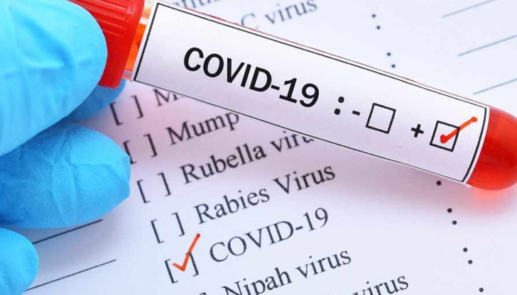 4 737 са новодиагностицираните с коронавирусна инфекция лица у нас
