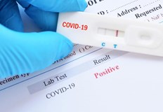 960 са новите положителни тестове за коронавируса у нас за