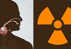 Как калиевият йодид помага срещу радиация Странични ефекти и рисковеИнформацията
