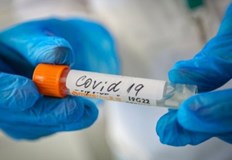 919 са новодиагностицираните с коронавирусна инфекция лица у нас през