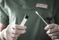 1 104 са новите случаи на коронавирус за последния денПоложителни са