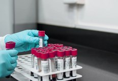 Общият брой на потвърдените случаи на заразяване с коронавирус у