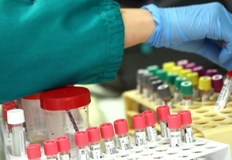 2180 са новите случаи на коронавирус потвърдени при направени 16 354