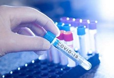 2125 са новодиагностицираните с COVID 19 лица у нас за изминалите 24