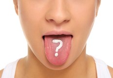 Много пациенти често се оплакват от специфичен вкус на йод