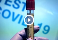 Нервната система и психиката са най засегнати от вируса добави проф