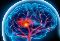 Сърдечносъдовият хирург и кардиолог Владимир Хорошев говори за опасностите от