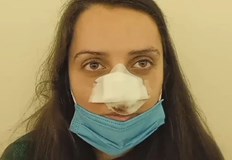 При инцидента носът на момичето е отхапанМладо момиче се нуждае