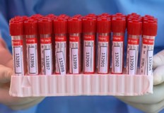 1140 са новите случаи на коронавирус потвърдени при направени 11