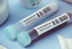 287 са новозаразените с COVID за последното денонощие С 344 случая