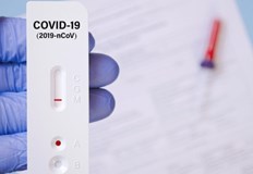 631 са новите случаи на заразяване с коронавирусТе са установени при