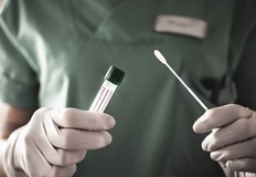 254 са новодиагностицираните с COVID 19 лица у нас за изминалите