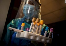 609 са новодиагностицираните с COVID 19 лица у нас през изминалото