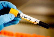 354 са новите заразени с коронавируса за последното денонощие В събота те