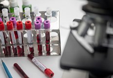 491 са новозаразените с COVID 19 сочат данните от