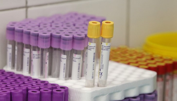 Активните случаи отново паднаха под 400 и към момента са 381 Активните случаи отново паднаха под 400 и към момента са 381