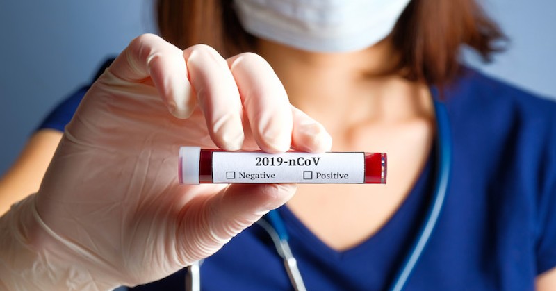 Петнайсет са заразените с Ковид-19 в Русенско за последните 24