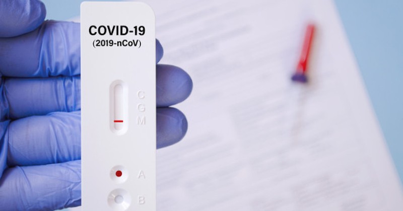 631 са новите случаи на заразяване с коронавирусТе са установени