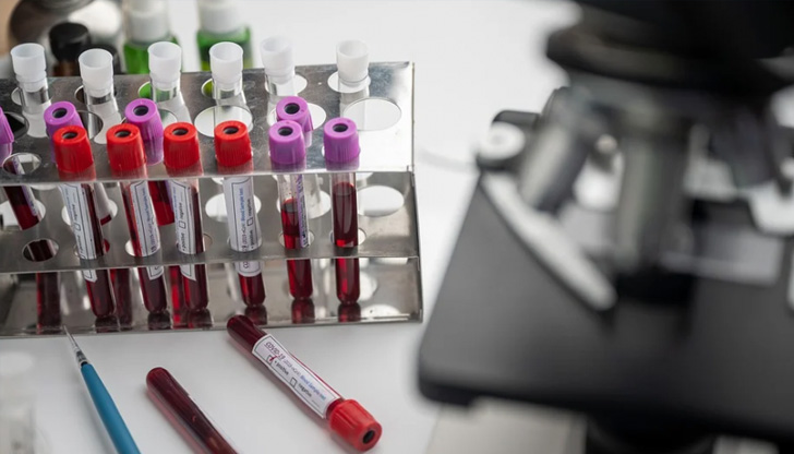 491 са новозаразените с COVID - 19, сочат данните от