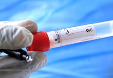 За последното денонощие 92 са новите положителни случаи у нас за вируса който