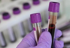 Огнища на заразата са регистрирани по рано и в други европейски