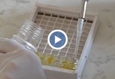 Пациентът е 4 годишно дете от ДупницаИма съмнения за случай на